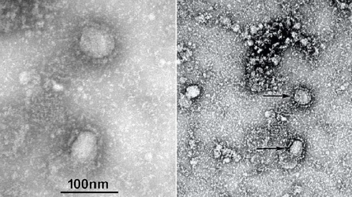 Ali Mohamed Zaki, Penemu Virus Corona dari Mesir