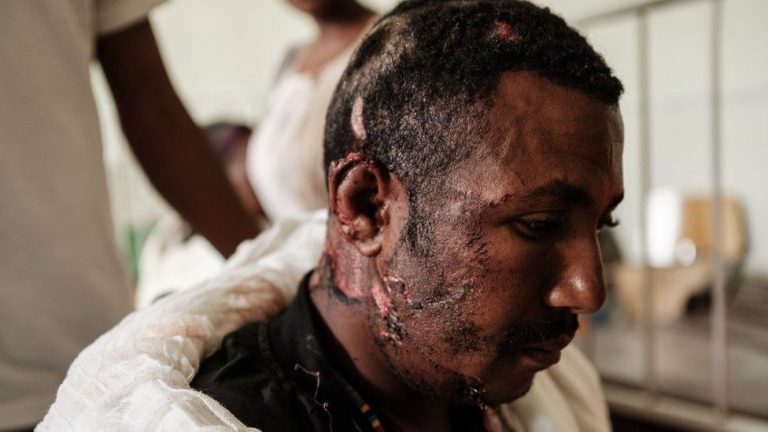 Ethiopia: Puluhan Orang Tewas dalam Serangan Udara Militer