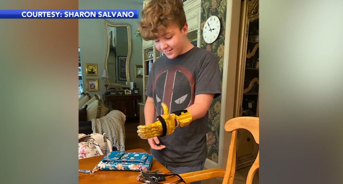 Siswa Remaja di New Jersey Buatkan Robot Tangan Palsu Untuk Temannya
