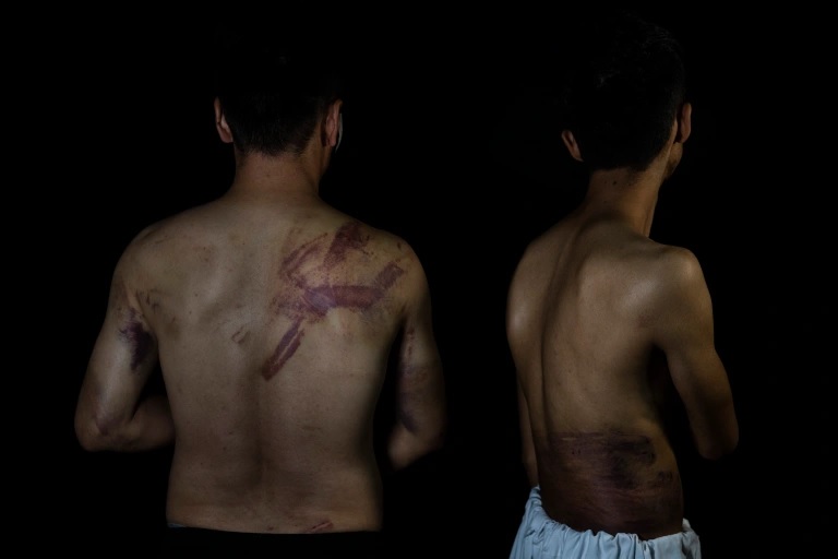Selama bulan September dan Oktober, terdapat ebih dari 30 kasus kekerasan dan ancaman kekerasan terhadap jurnalis Afghanistan. Foto: AP Foto.
