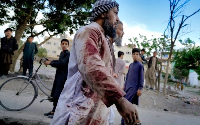 Seorang jemaah yang berlumuran darah berjalan dari masjid tempat ledakan terjadi di Kabul pada Jumat, 29 April 2022. Foto: Ebrahim Noroozi/AP.