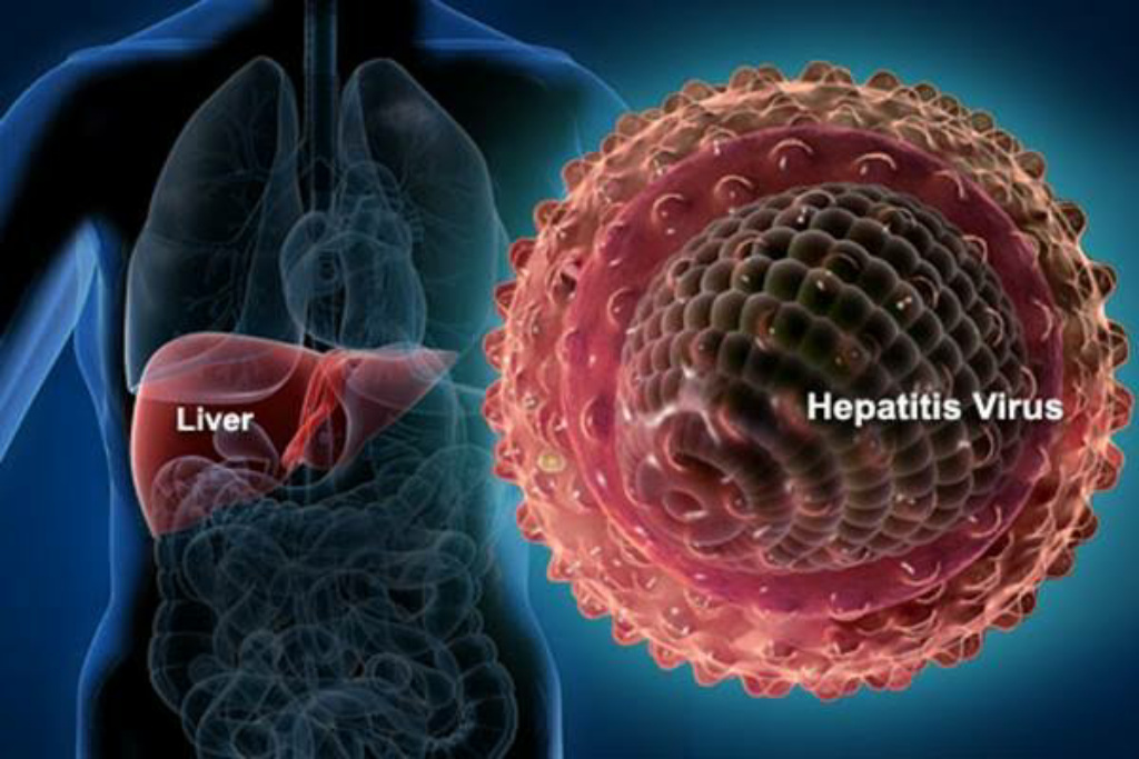 Kemenkes Ungkap Kondisi 3 Pasien Anak Hepatitis 'Misterius' yang Meninggal