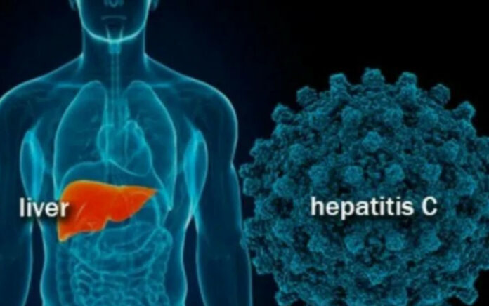 Biaya Perawatan Pasien Hepatitis Ditanggung BPJS Kesehatan