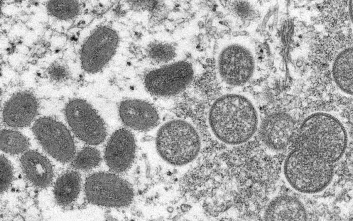 Gambar mikroskop elektron tahun 2003 dari virion monkeypox dewasa berbentuk oval yang diperoleh dari sampel kulit manusia pada tahun 2003. Foto: Pusat Pengendalian dan Pencegahan Penyakit AS via LATimes.