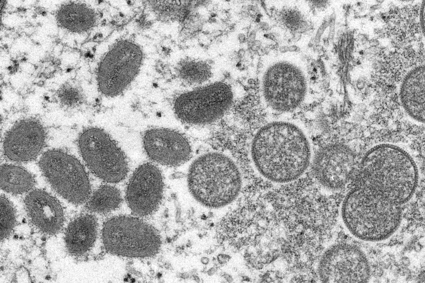 Gambar mikroskop elektron tahun 2003 dari virion monkeypox dewasa berbentuk oval yang diperoleh dari sampel kulit manusia pada tahun 2003. Foto: Pusat Pengendalian dan Pencegahan Penyakit AS via LATimes.