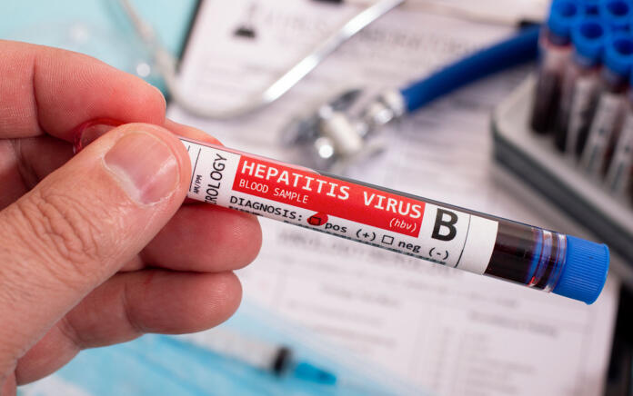 Hepatitis B