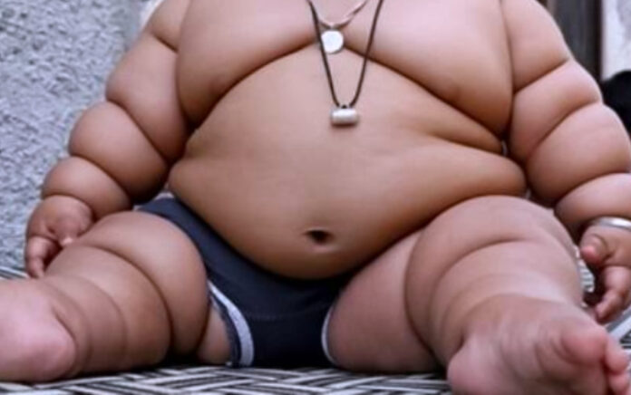 Pemerintah Berupaya Tekan Kasus Obesitas Sampai 3 Persen di Tahun 2030