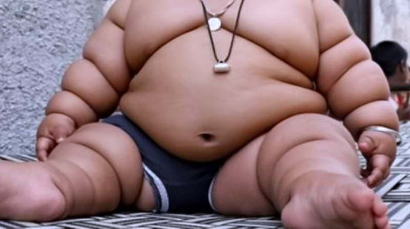 Pemerintah Berupaya Tekan Kasus Obesitas Sampai 3 Persen di Tahun 2030